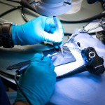 Endoscopy: Endoscopy Cost, Types & More