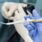 Endoscopy: What to know